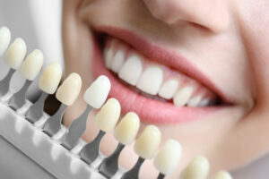 Young woman choosing color of teeth at dentist, closeup