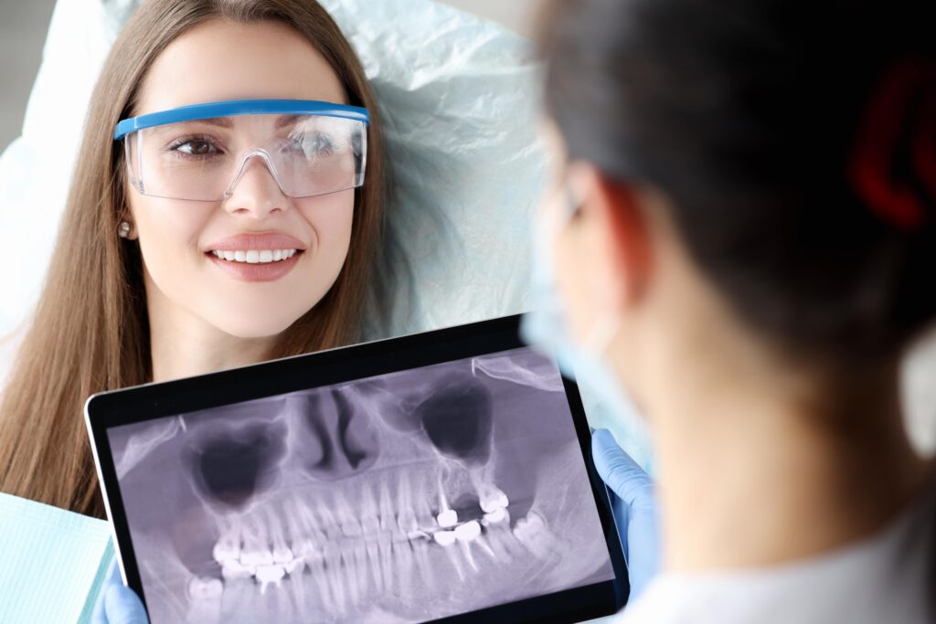 What Are the Benefits of Digital Dental X-Rays?