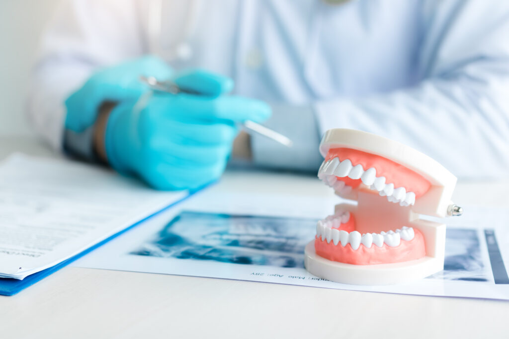 Dental Implants vs. Dentures - Which One Is Right for Me? 