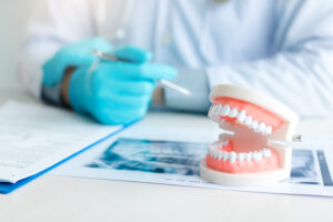 Dental Implants vs. Dentures - Which One Is Right for Me? 