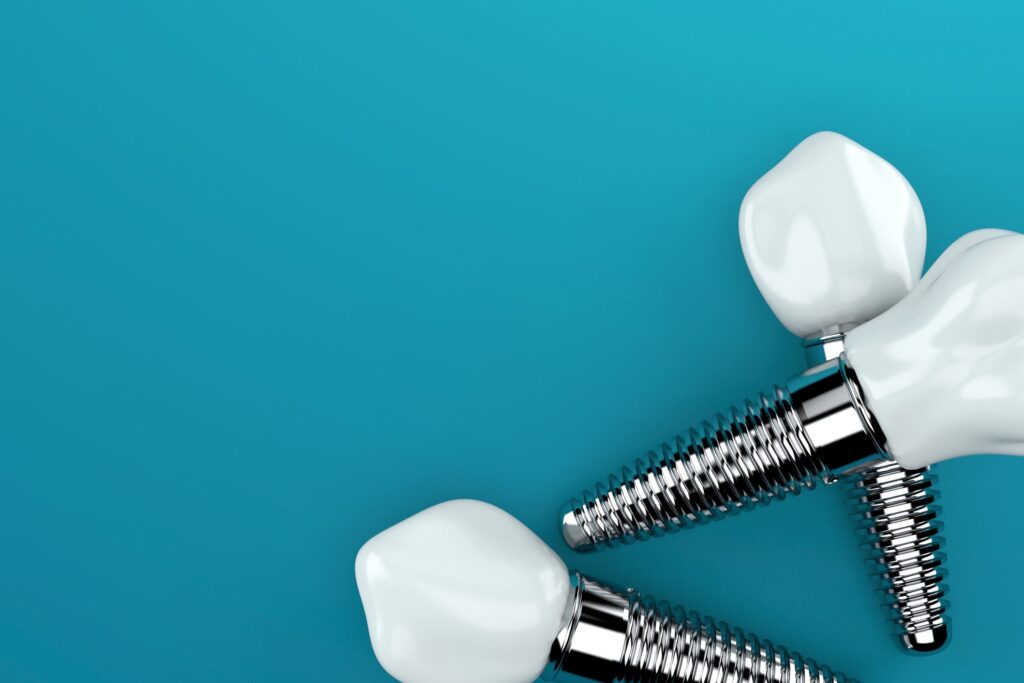 Are Dental Implants Right for Me?